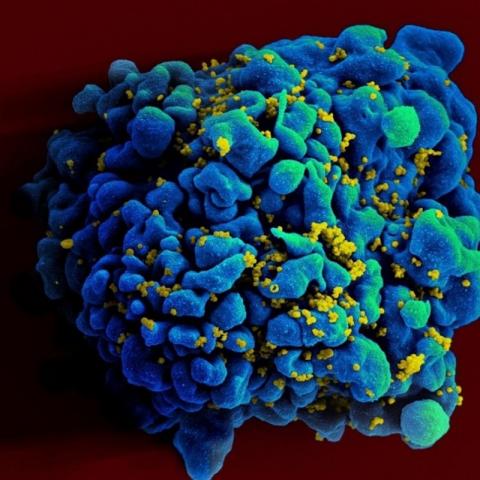 Una mujer argentina se habría curado de VIH por inmunidad natural